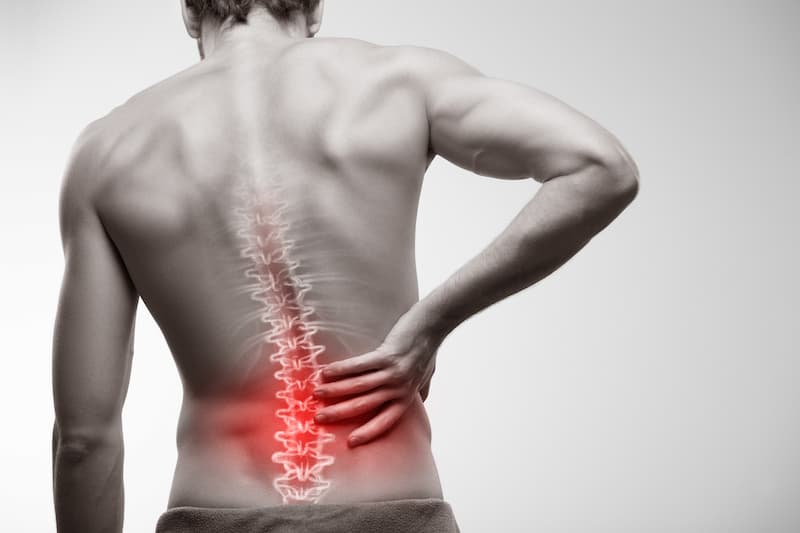 Incapacidad permanente por síndrome facetario lumbar